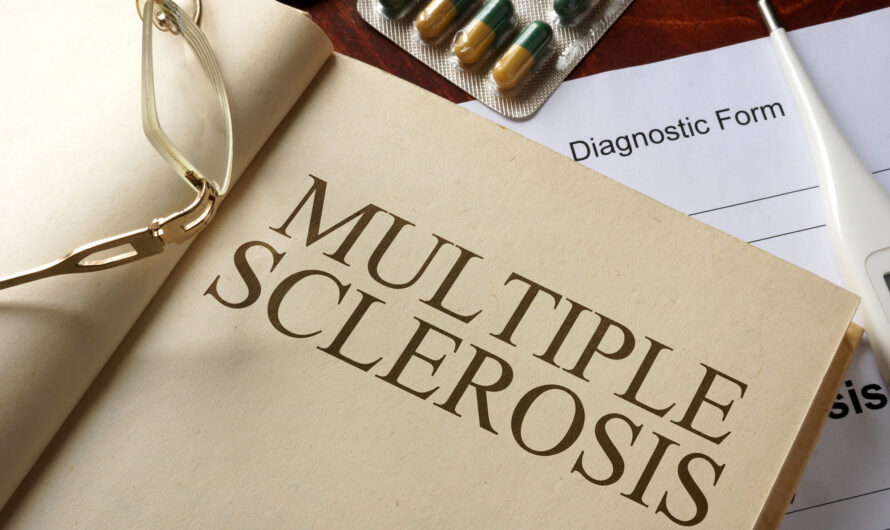 Is Multiple Sclerosis Fatal? All You Need To Know